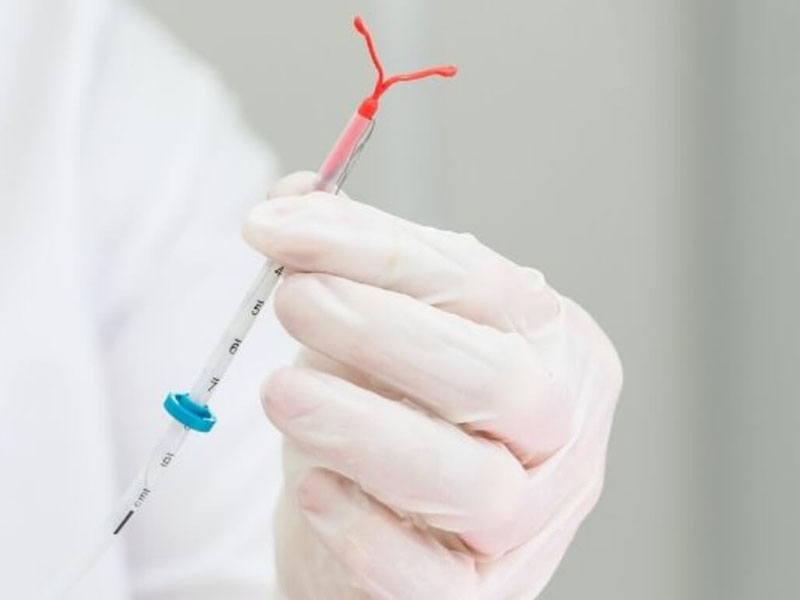 IUD removal in Greenock / Scotland