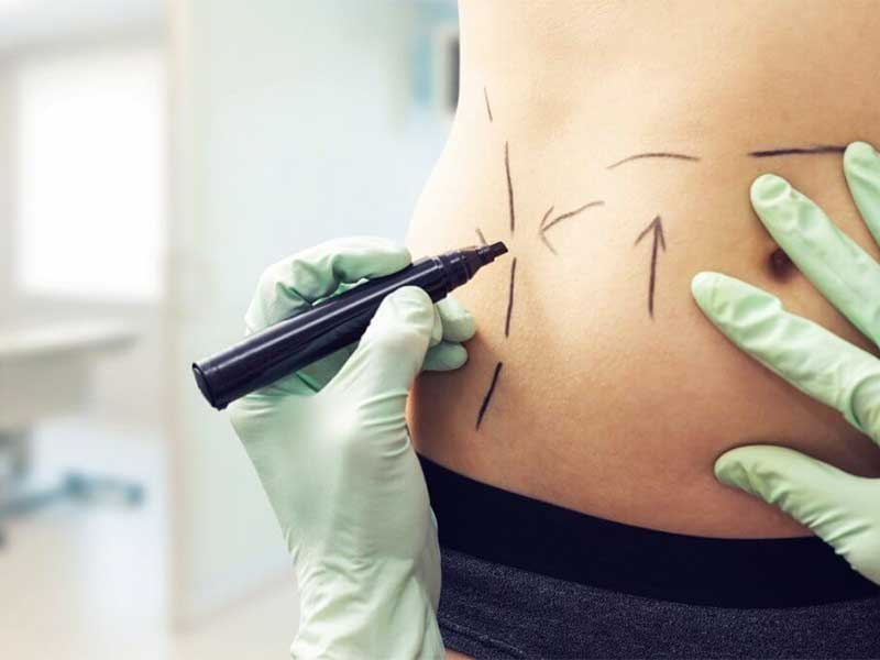 Plastic surgery in Greenock / Scotland