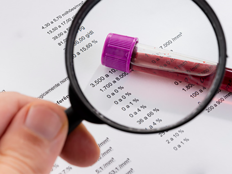 Complete blood count in Greenock / Scotland