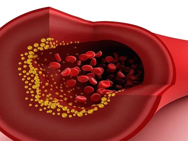 Total cholesterol in Greenock / Scotland